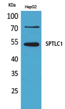 SPTLC1 rabbit pAb Antibody