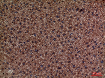 PEPCK-C rabbit pAb Antibody
