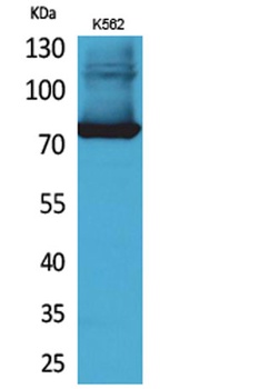 Transferrin rabbit pAb Antibody