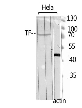 Transferrin rabbit pAb Antibody