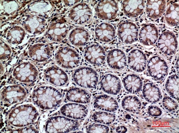 CD59 rabbit pAb Antibody