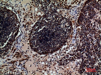 CD79b rabbit pAb Antibody