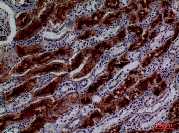 GGT1 rabbit pAb Antibody