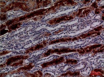 GGT1 rabbit pAb Antibody