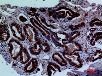 CD229 rabbit pAb Antibody