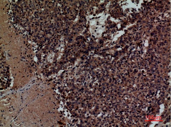 CD158z rabbit pAb Antibody
