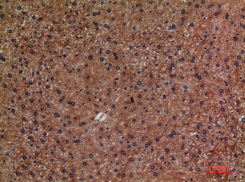 CD276 rabbit pAb Antibody