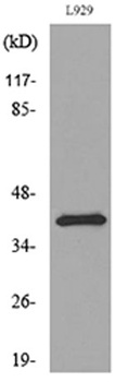 PDGF-D rabbit pAb Antibody