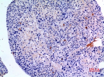 BMP-3A rabbit pAb Antibody