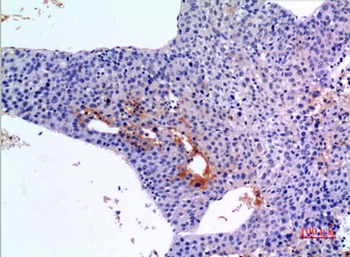 BMP-3A rabbit pAb Antibody