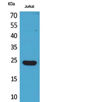 IFN-ε rabbit pAb Antibody