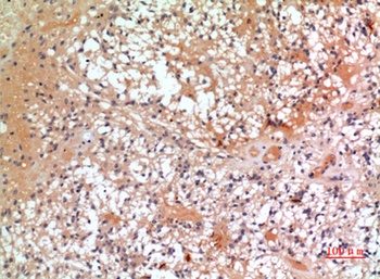 CMTM6 rabbit pAb Antibody