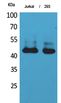 SCCA1/2 rabbit pAb Antibody