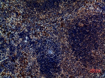 Pax-5 rabbit pAb Antibody