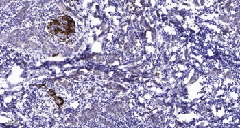RFC1 rabbit pAb Antibody