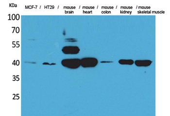IDH3A rabbit pAb Antibody