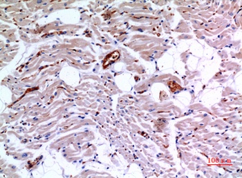 IDH3A rabbit pAb Antibody