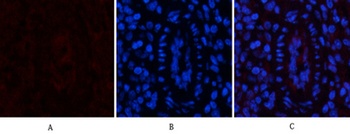 EPAS-1 rabbit pAb Antibody