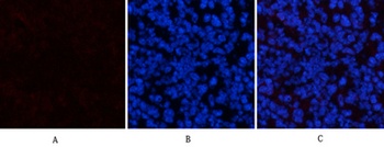 EPAS-1 rabbit pAb Antibody