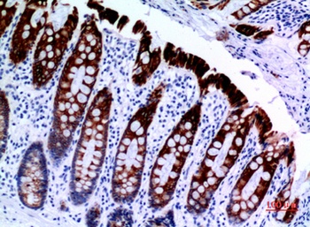 Cytokeratin 8 rabbit pAb Antibody