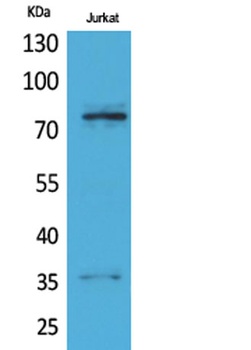 p73 rabbit pAb Antibody