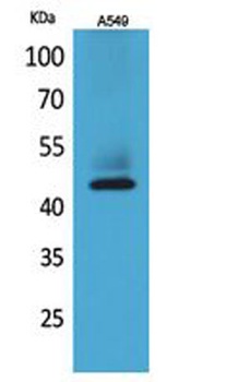 Cytokeratin 19 rabbit pAb Antibody