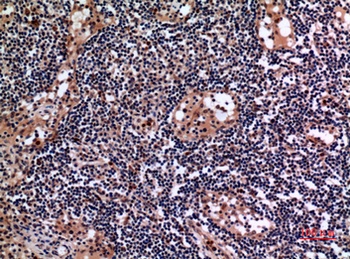 Cytokeratin 19 rabbit pAb Antibody