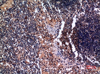 Cytokeratin 19 rabbit pAb Antibody