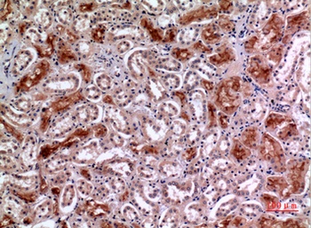 CD10 rabbit pAb Antibody