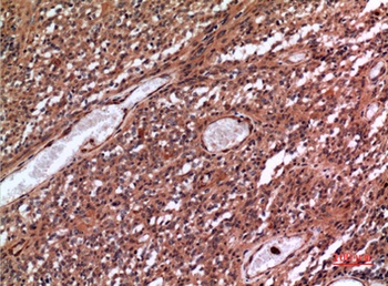 CD10 rabbit pAb Antibody