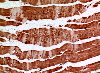 ALDH2 rabbit pAb Antibody