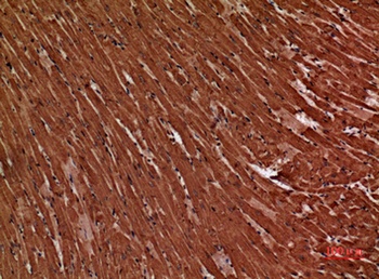 Troponin T-C rabbit pAb Antibody