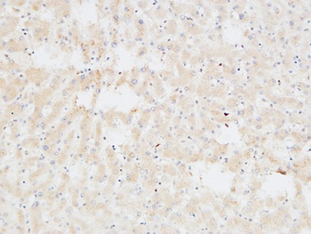 Troponin T-C rabbit pAb Antibody