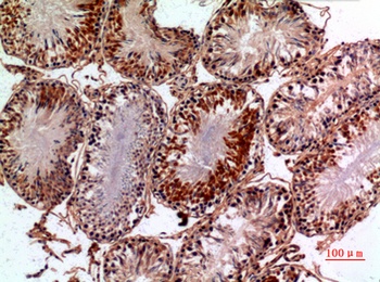 NTE rabbit pAb Antibody