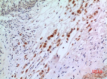 IFN-αR2 rabbit pAb