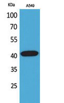 L-Selectin rabbit pAb Antibody