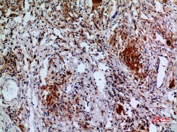 Apaf-1 rabbit pAb Antibody