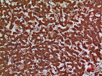 Laminin γ-2 rabbit pAb Antibody