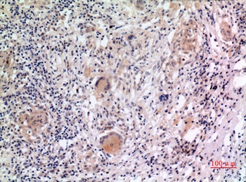 Cryopyrin rabbit pAb Antibody