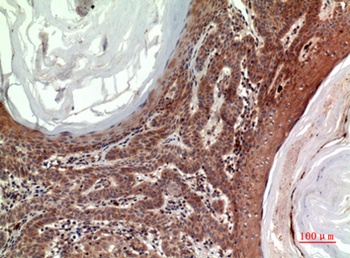 Inhibin β-B rabbit pAb Antibody