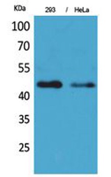 IDH1 rabbit pAb Antibody