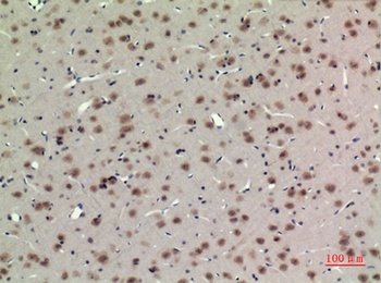 BMAL1 rabbit pAb Antibody