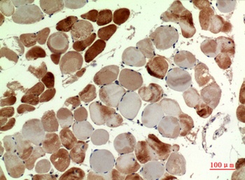 MYH-pan rabbit pAb Antibody