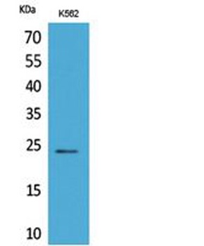 CyPB rabbit pAb Antibody