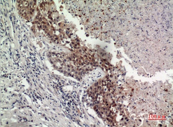 GPR87/95 rabbit pAb Antibody