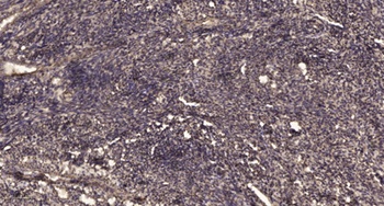 KLK1 rabbit pAb Antibody