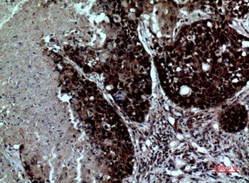 Integrin αD rabbit pAb Antibody