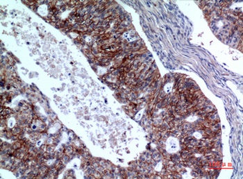 IL-1RII rabbit pAb Antibody