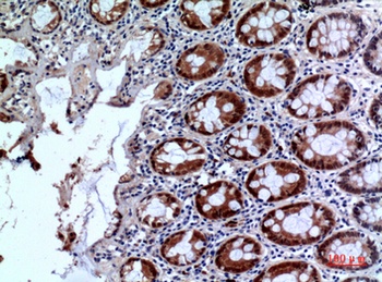 IL-1RII rabbit pAb Antibody