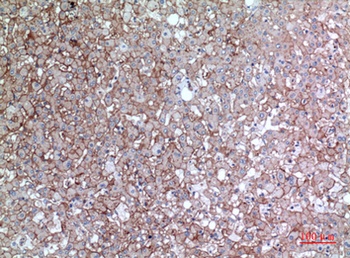 EMMPRIN rabbit pAb Antibody